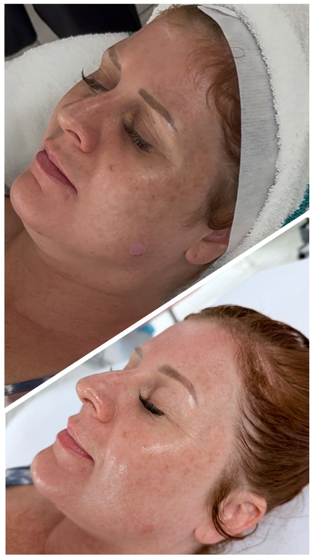 Custom Facial